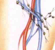Otok limfnih čvorova u preponi kod muškaraca i žena