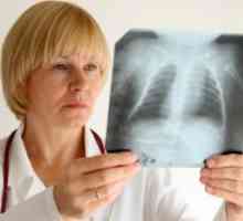 WHO upozorava na povratak tuberkuloze