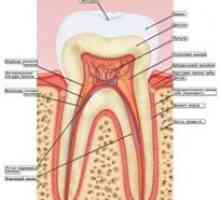 Bolesti desni: gingivitis, parodontitis (bolesti desni), paradentoze