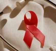 Žene su posebno u opasnosti od HIV-a