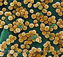 Staphylococcus aureus u grlu