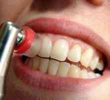 Zubni plak (oralnu higijenu)
