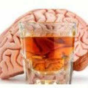 Alkoholna encefalopatija