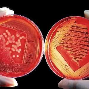 Bakterijski šok u uroloških bolesti