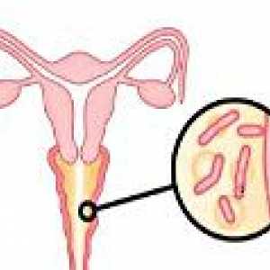 Bakterijske vaginoze