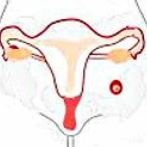 Abdominalna trudnoća