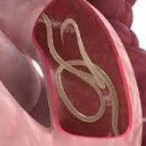Crijevna glista infekcije kod djece