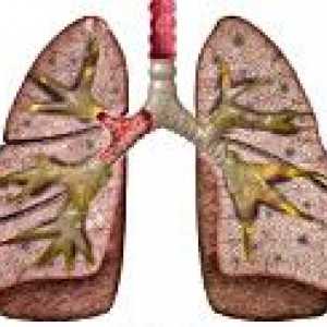 Hronične upale pluća