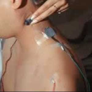 Elektromiografija (EMG)