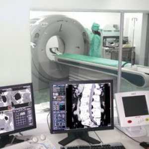 Kompjuterska tomografija (CT tomografija), X-ray