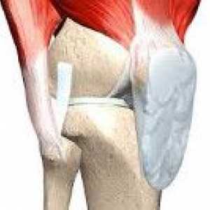 Kontraktura zgloba koljena