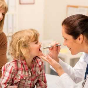 Tretman infektivne mononukleoze kod djece