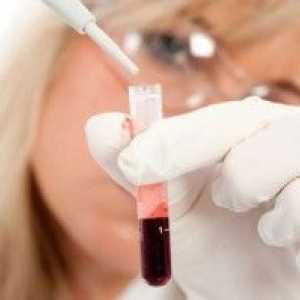 Leukociti u krvi za vrijeme trudnoće