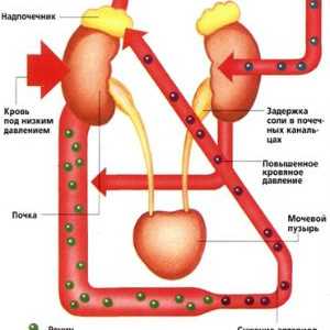 Bubrežne arterijska hipertenzija (bubrega pritisak)