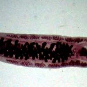 Opisthorchiasis (Vinogradov bolest)