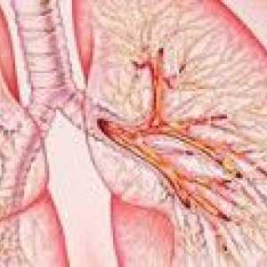 Akutnog opstruktivnog bronhitisa