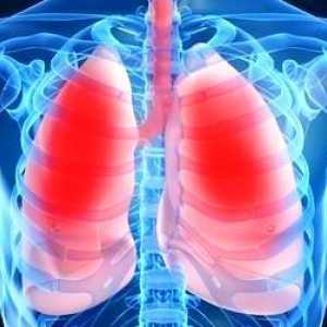 Plućni edem: uzroci, simptomi, liječenje