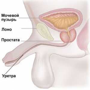 Parotitisa (Mumps)