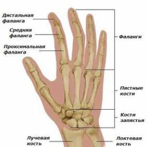 Fractured prst