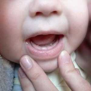 Znaci izbijanje zuba kod beba