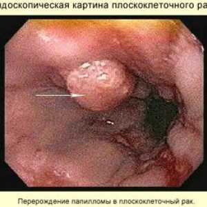 Malignih tumora probavnog sistema