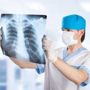 Grudi X-zraka dijete, sve što roditelji trebaju znati