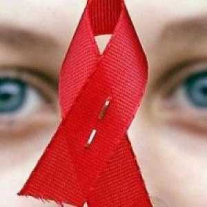 Simptomi HIV-a