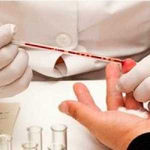 Sklonost ka altsgymera bolesti odrediti test krvi