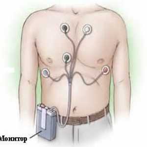 Dnevno (Holter) EKG praćenje i pakao