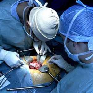 Transplantacija bubrega (transplantacija bubrega)