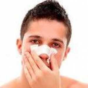 Povreda i zakrivljenost nosa