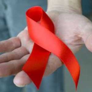 HIV infekcije i AIDS-a