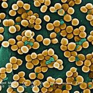 Staphylococcus aureus u grlu
