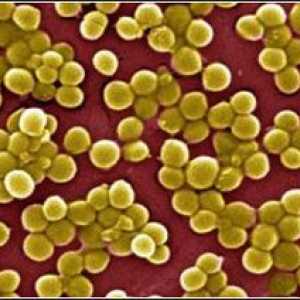 Staphylococcus aureus u stomak